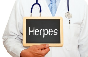 Herpes