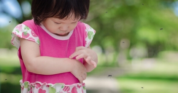 Was hilft Kindern bei Mückenstichen